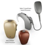 Bone Anchored Hearing Aid Fitting Clinic