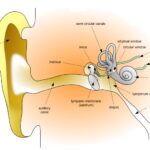 Pure Tone Audiometry
